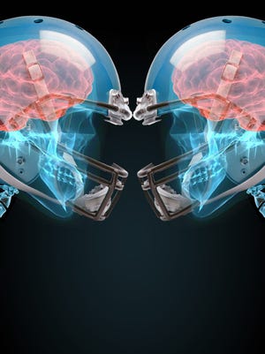 Concussion-related lawsuits are flowing through courts at a no-huddle pace.